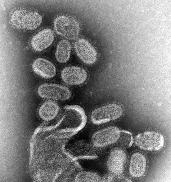Key Difference - Coronavirus vs Influenza